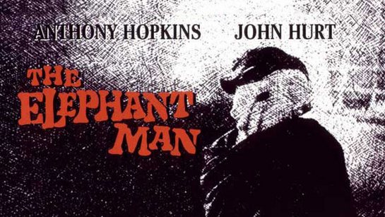 ფილმები, რომელიც უნდა ნახო სანამ ცოცხალი ხარ - ადამიანი-სპილო / The Elephant Man