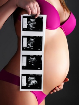 ფეხმძიმობის მე-20 კვირა - ულტრაბგერითი გამოკვლევები და ნაყოფის სქესი